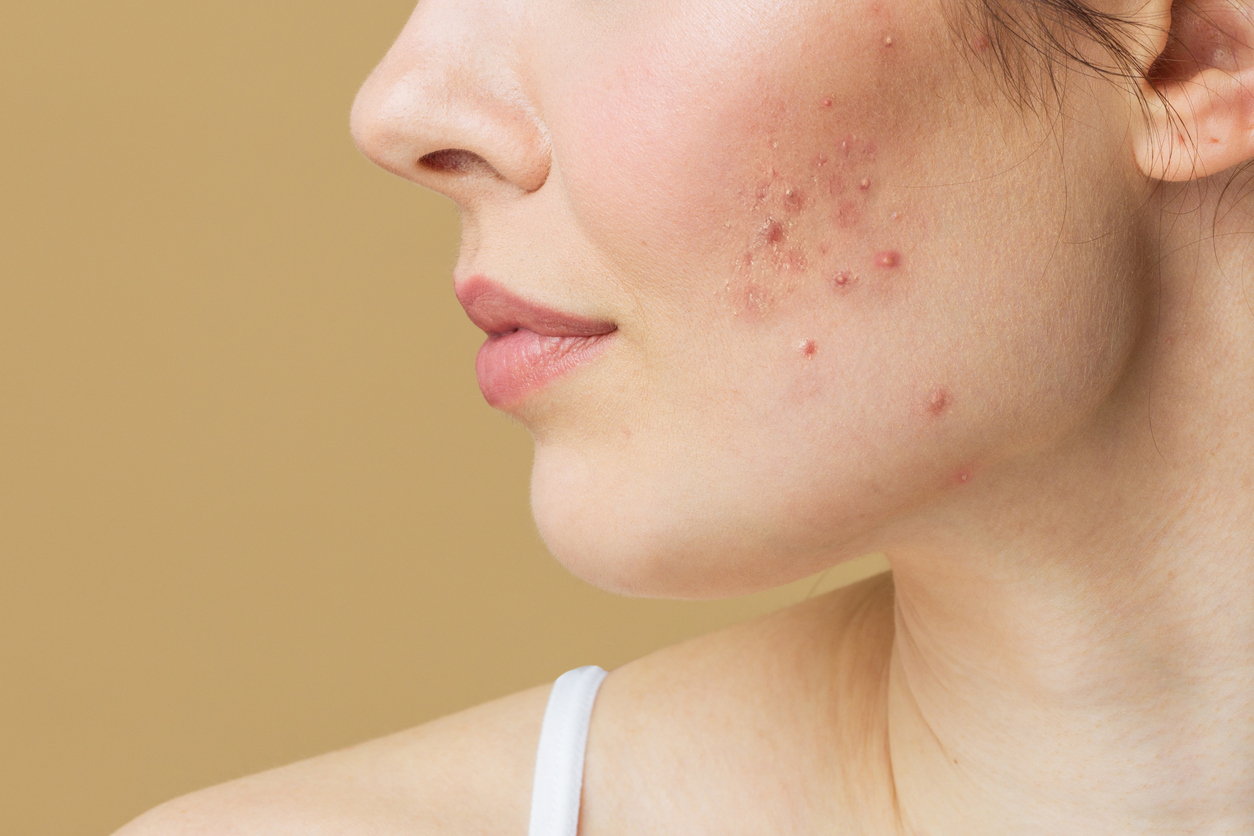 Dermatologist examining a patient's skin during a consultation